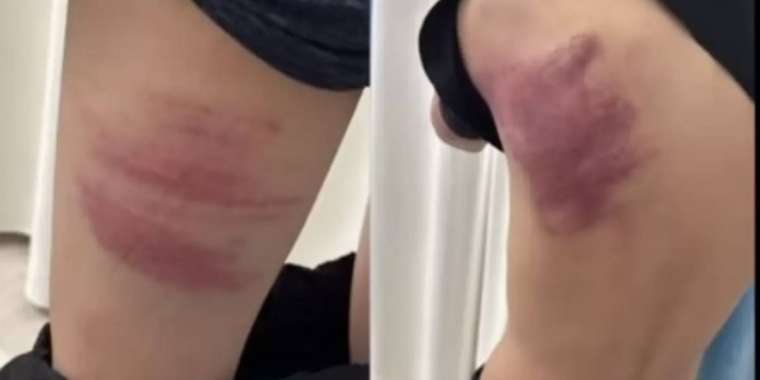 Атырау облысында оқушылар екі жасөспірімді қатыгездікпен ұрып-соққан