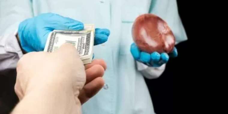 Ақтөбелік ішкі органдарын сатпақ болған