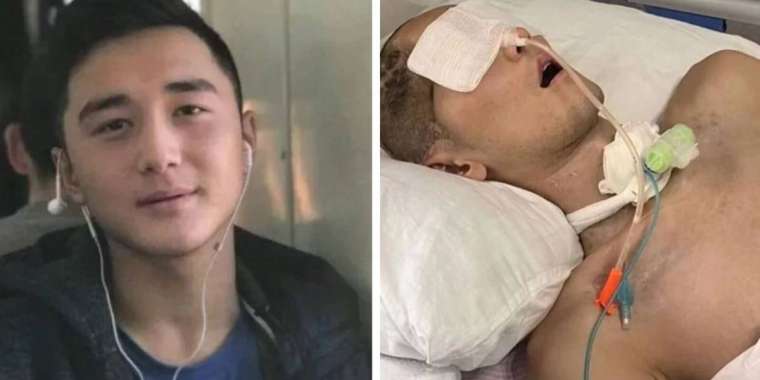 «Ербаян қайтадан Стамбулға барады». Әскерде соққы алған жігіттің жағдайы айтылды