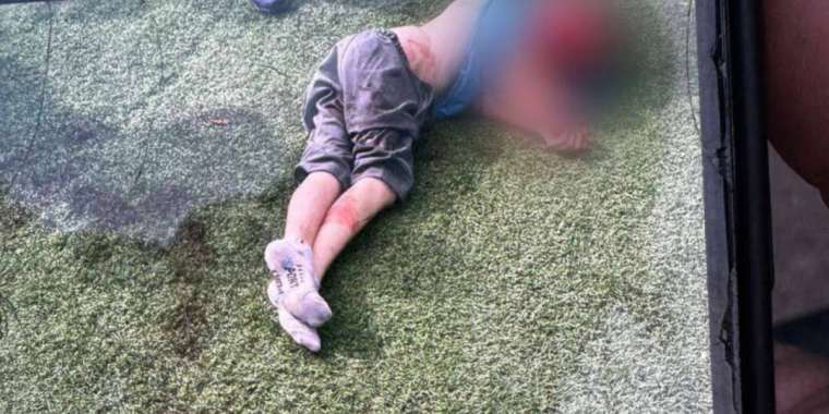 Итке таланған баланың жағдайы белгілі болды