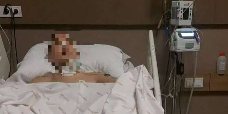 Өскеменде 3 жасар бала алтыншы қабаттан құлап кетті