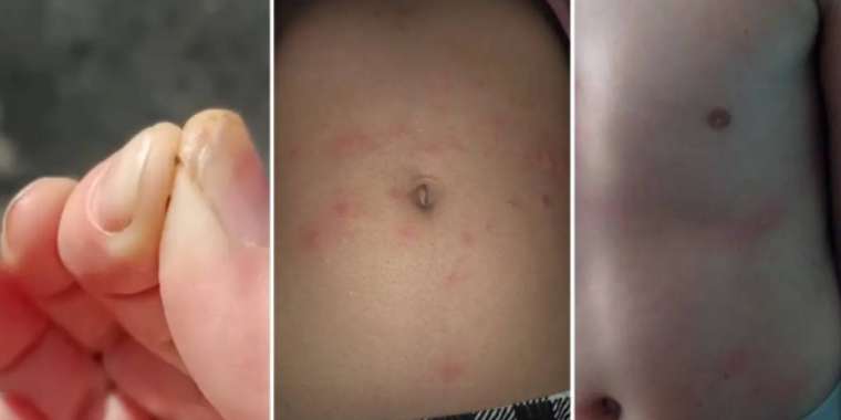 Ауызша секс және тонзиллит