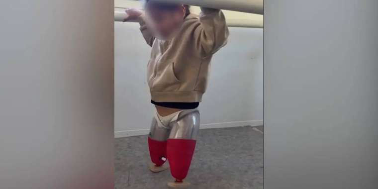 Автобус апатынан екі аяғынан айырылған қыз протезбен жүруді үйрене бастады