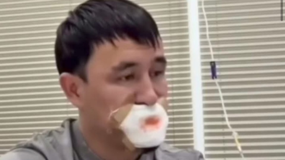 Қызбен сүйісемін деп тілінен айрылып қалған жігіт туралы тың мәлімет тарады