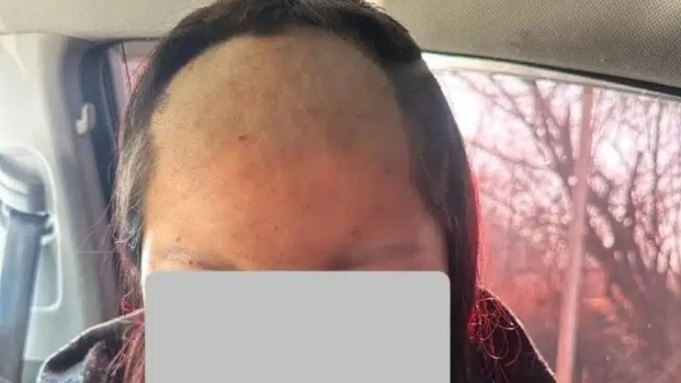 Кәмелетке толмаған қызды ұрып-соғып, шашын қырып тастаған (ФОТО)