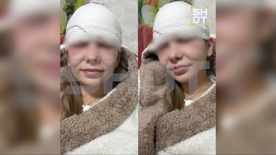 "Безеуін сығамын деп өмірінен айрылып қала жаздады": 28 жастағы келіншек адам сенгісіз жағдайға түсіп қалды (ФОТО)