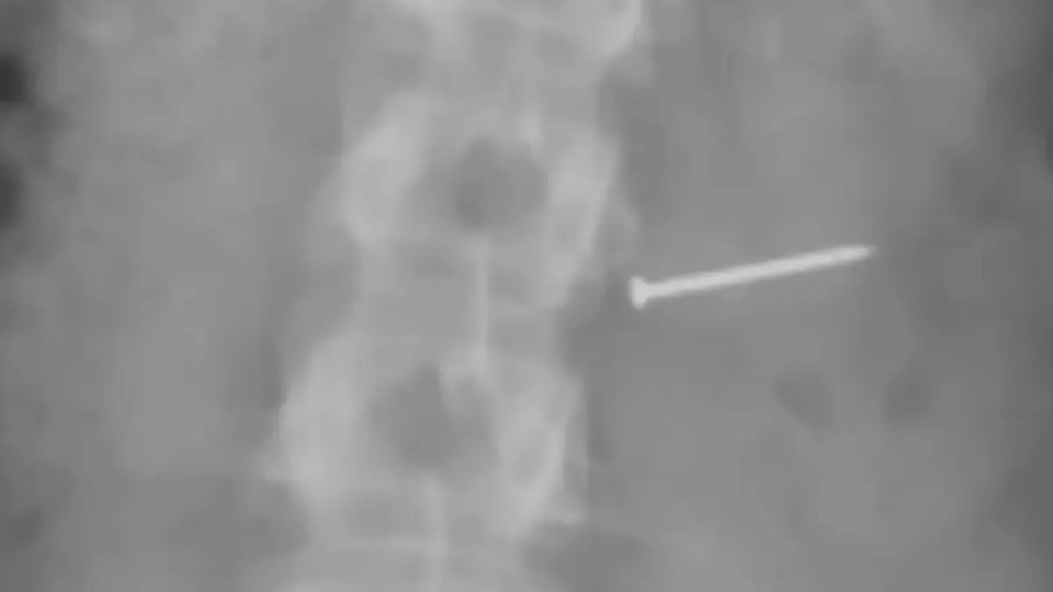 Балмұздақтың ішінен шеге шықты: Әйел адам тосын жағдайға тап болып, артынша миллионер атанды (ФОТО)