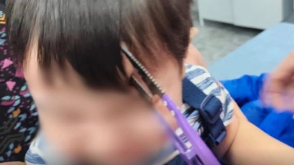 Алматылық дәрігерлер маңдайына қайшы қадалған баланы құтқарды