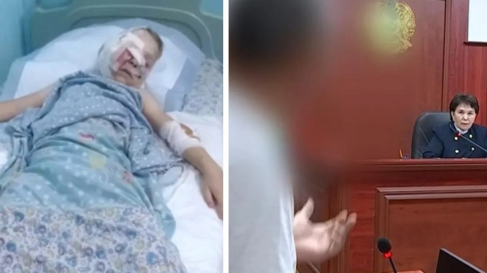 11 жасар балаға бірнеше ит шабуыл жасаған: Жануарлардың иесі сотталып жатыр